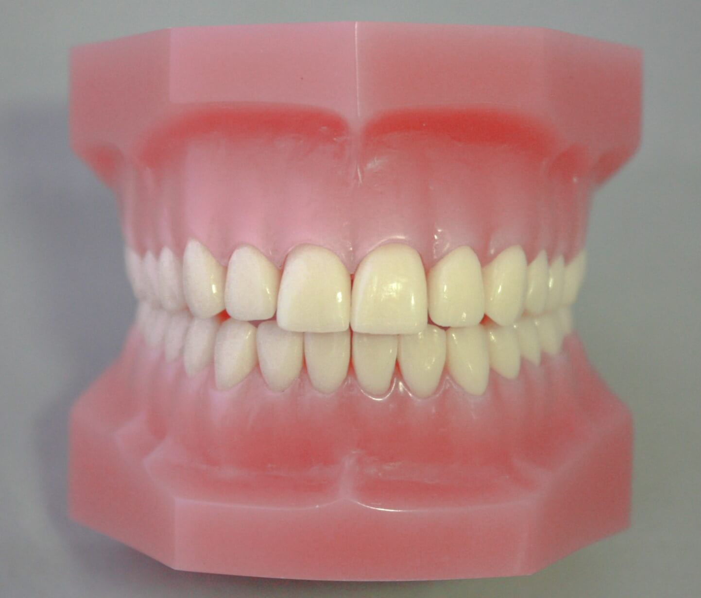 歯科模型画像