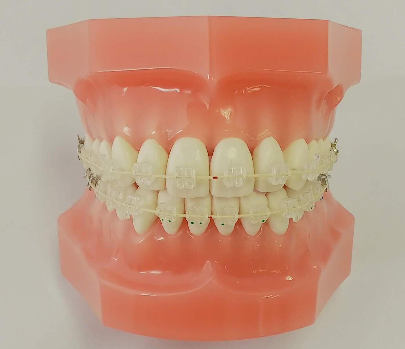 歯科模型（ブラケット付）画像